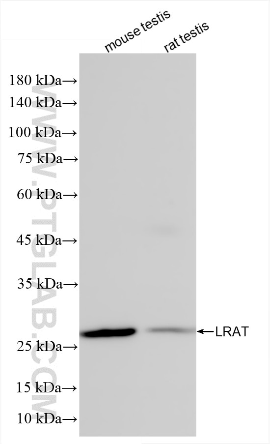 Western Blot (WB) analysis of various lysates using LRAT Recombinant antibody (85628-1-RR)