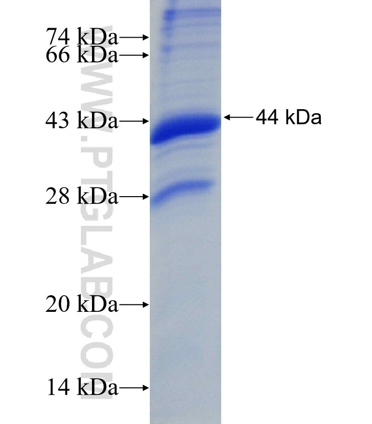 LRAT fusion protein Ag3556 SDS-PAGE
