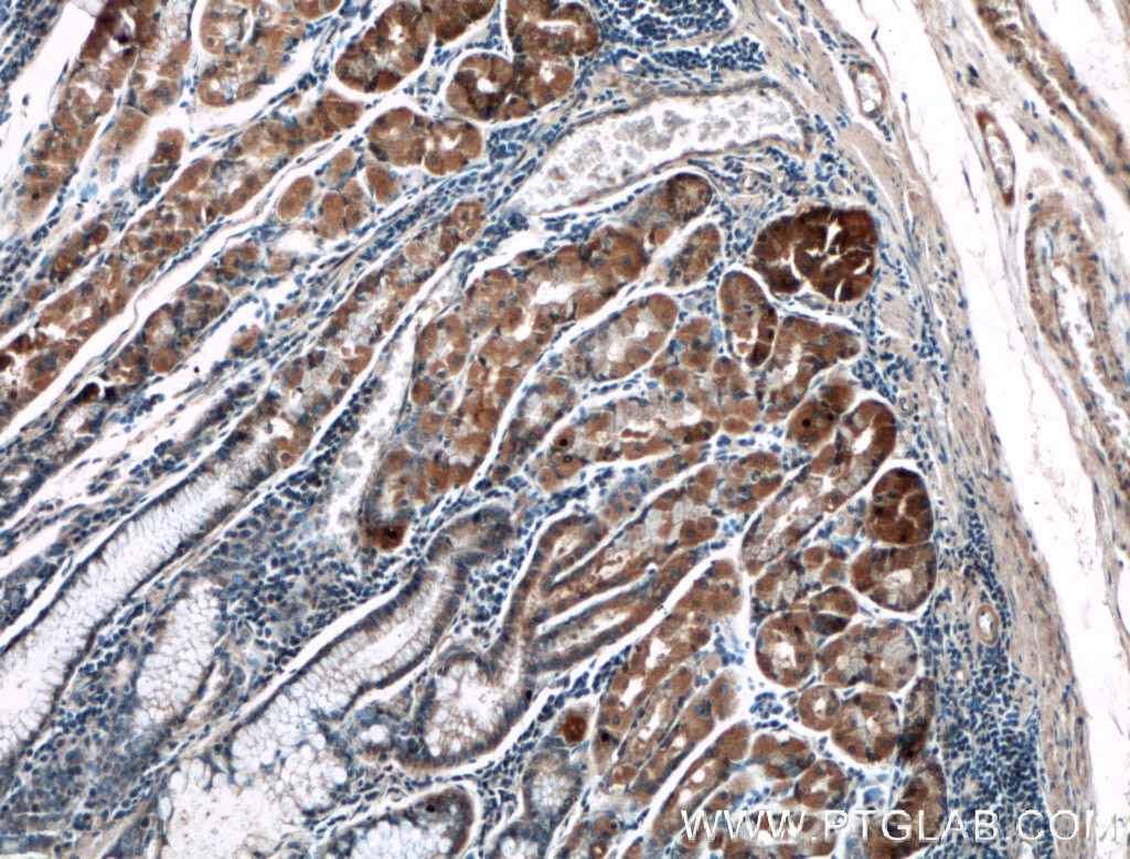 Immunohistochemistry (IHC) staining of human stomach tissue using LRBA Polyclonal antibody (27597-1-AP)