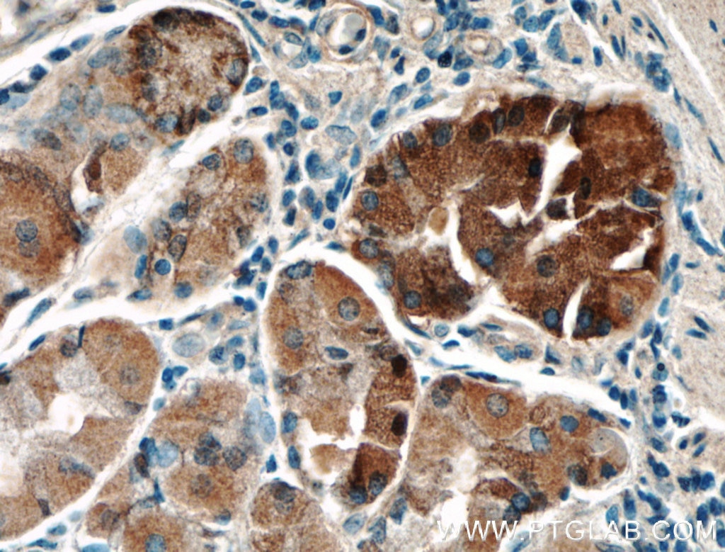 Immunohistochemistry (IHC) staining of human stomach tissue using LRBA Polyclonal antibody (27597-1-AP)