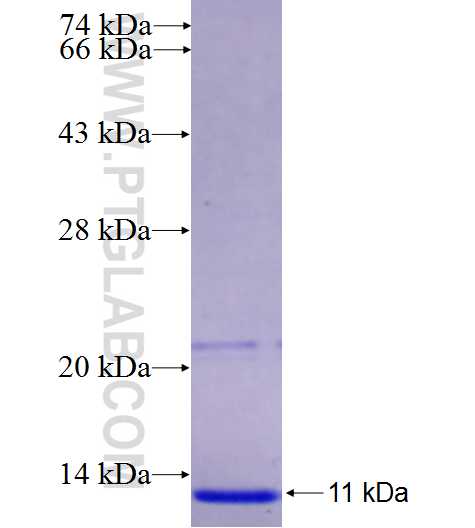 LRBA fusion protein Ag25596 SDS-PAGE