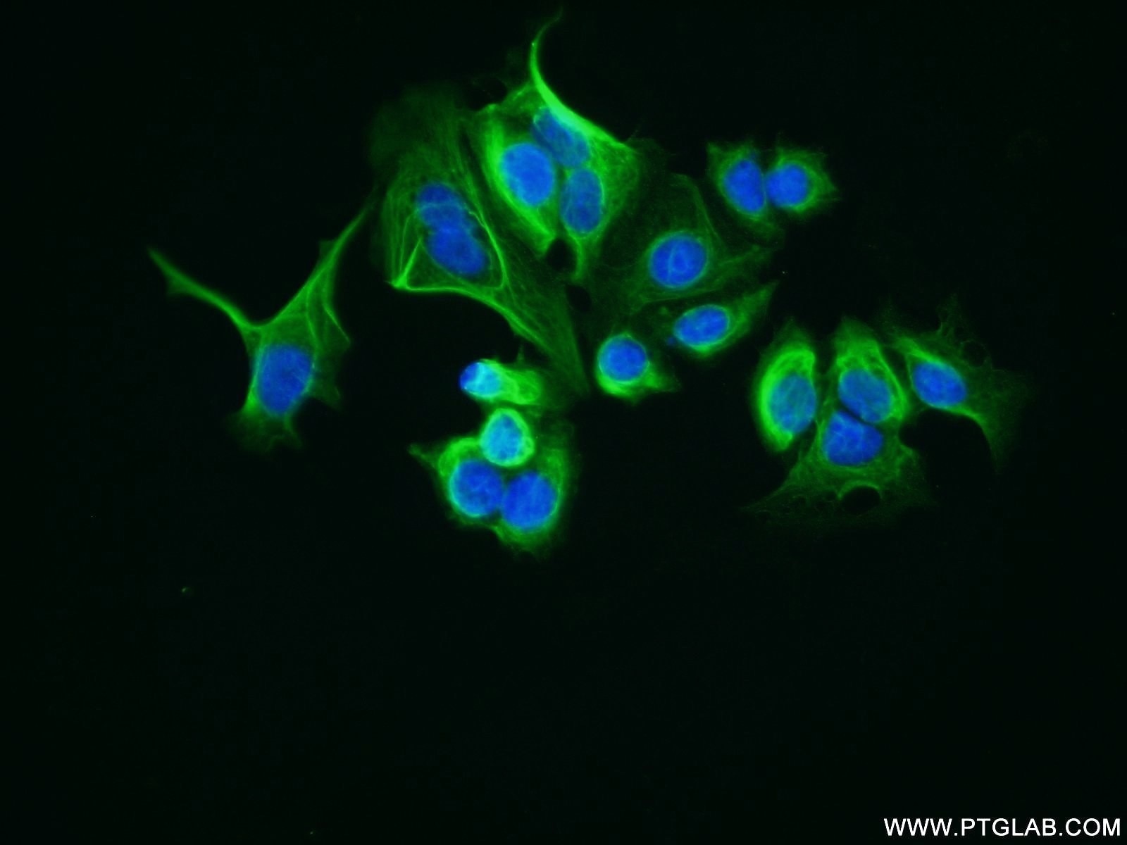 Immunofluorescence (IF) / fluorescent staining of MCF-7 cells using LRCH1 Polyclonal antibody (25017-1-AP)