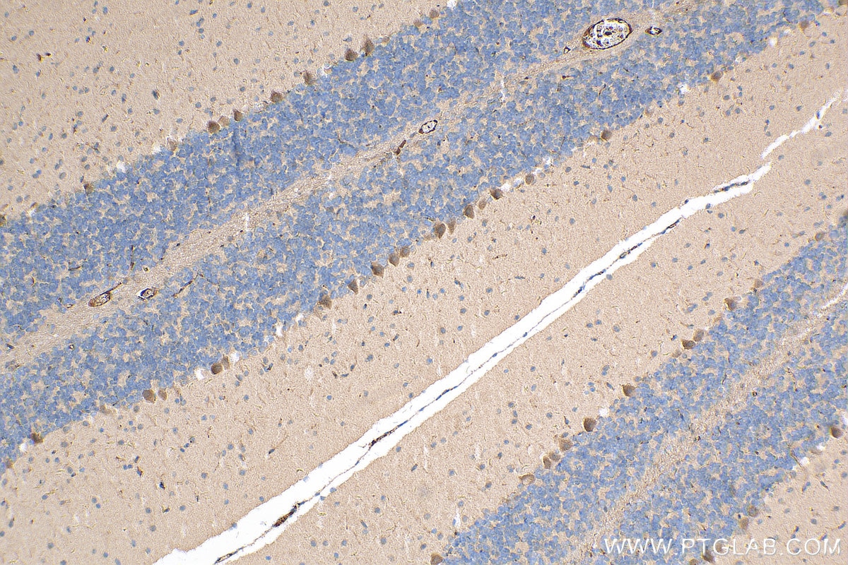 Immunohistochemistry (IHC) staining of mouse cerebellum tissue using LRCH1 Polyclonal antibody (25017-1-AP)