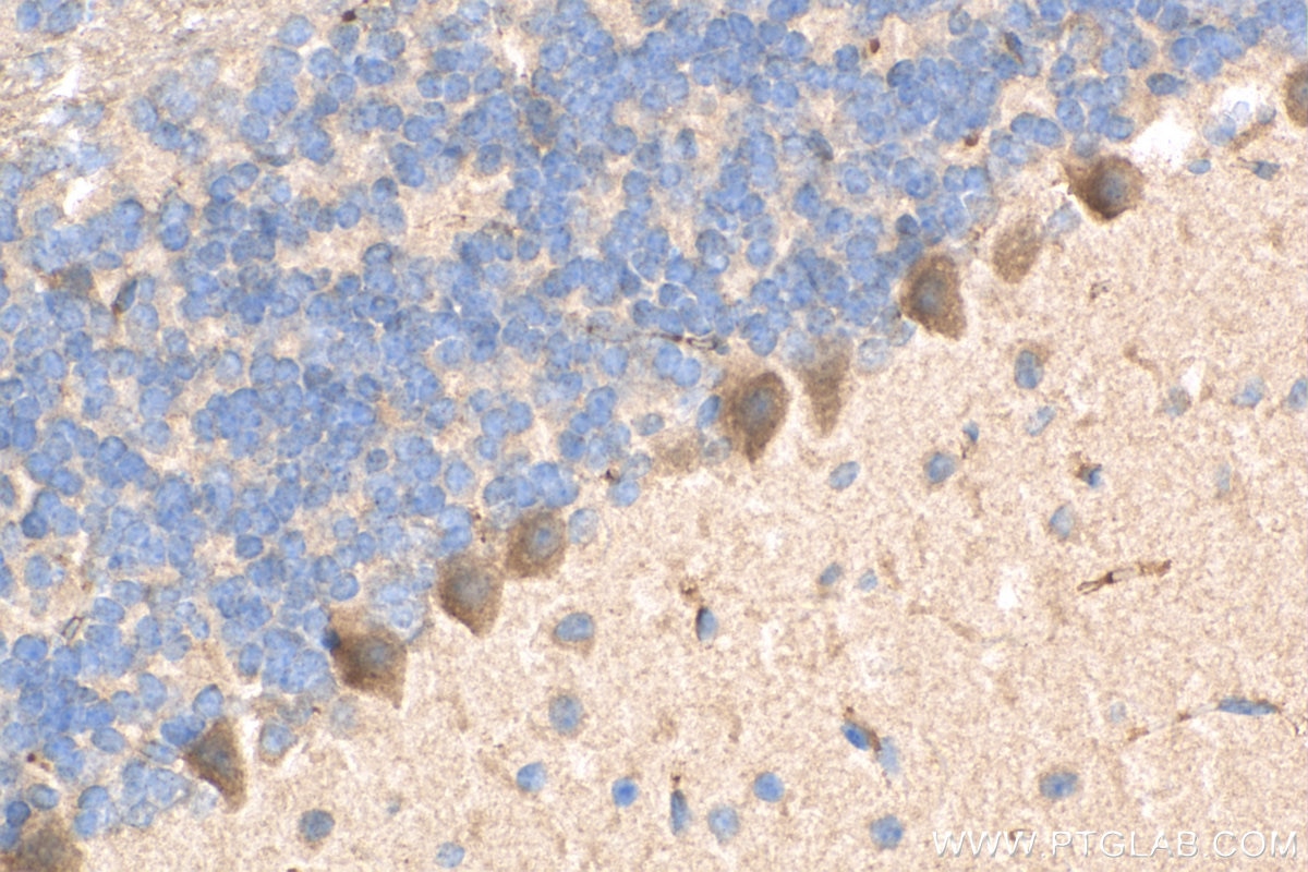 Immunohistochemistry (IHC) staining of mouse cerebellum tissue using LRCH1 Polyclonal antibody (25017-1-AP)