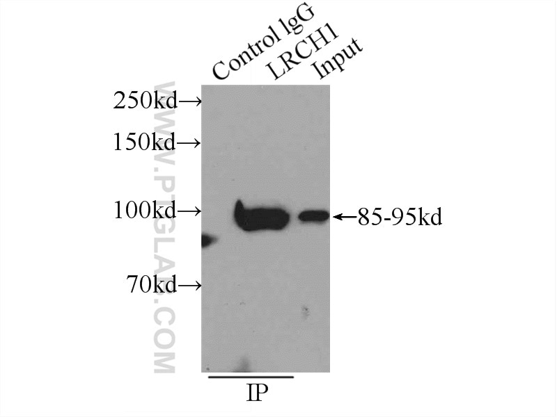 Immunoprecipitation (IP) experiment of HeLa cells using LRCH1 Polyclonal antibody (25017-1-AP)