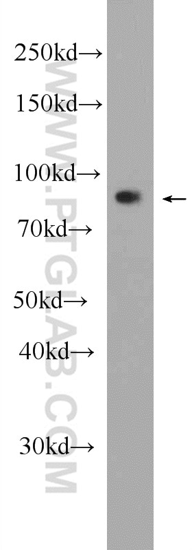 Western Blot (WB) analysis of HeLa cells using LRCH1 Polyclonal antibody (25017-1-AP)