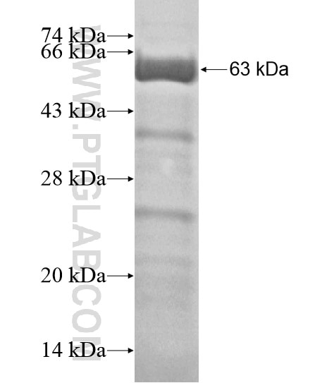 LRCH1 fusion protein Ag18728 SDS-PAGE