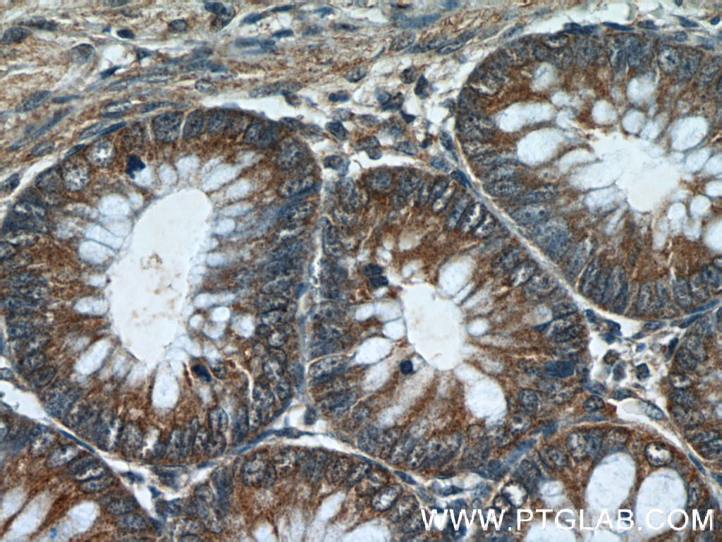 Immunohistochemistry (IHC) staining of human colon tissue using LRCH2 Polyclonal antibody (24866-1-AP)