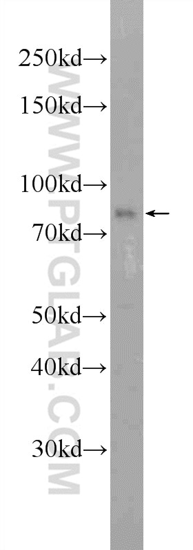 Western Blot (WB) analysis of mouse heart tissue using LRCH2 Polyclonal antibody (24866-1-AP)