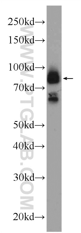 Western Blot (WB) analysis of mouse brain tissue using LRCH2 Polyclonal antibody (24866-1-AP)