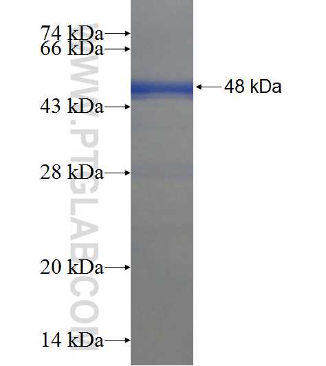 LRCH2 fusion protein Ag21701 SDS-PAGE