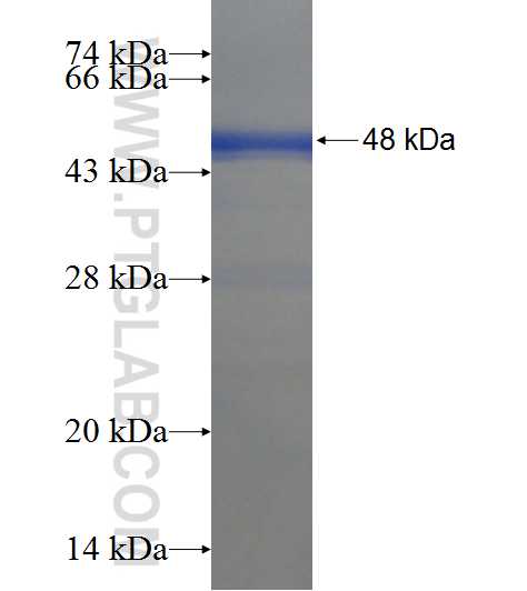 LRCH2 fusion protein Ag21701 SDS-PAGE