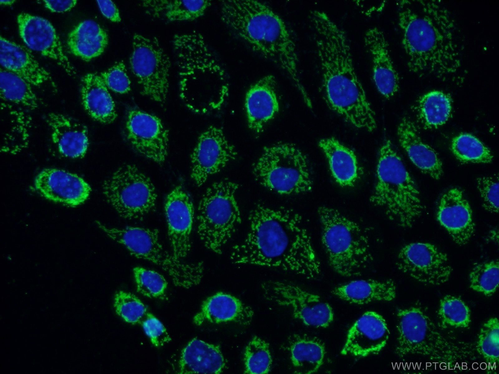 Immunofluorescence (IF) / fluorescent staining of A431 cells using LRCH3 Polyclonal antibody (15800-1-AP)