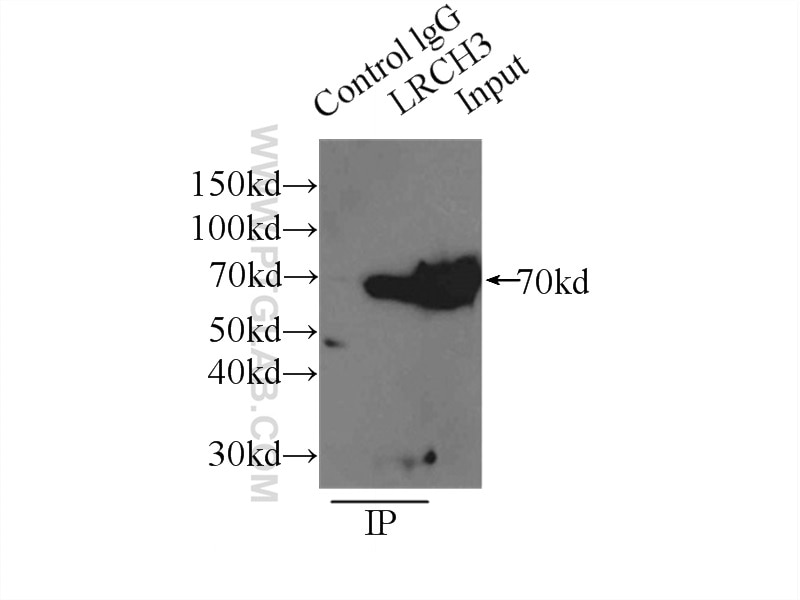 Immunoprecipitation (IP) experiment of mouse liver tissue using LRCH3 Polyclonal antibody (15800-1-AP)