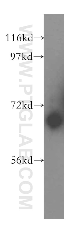 Western Blot (WB) analysis of Jurkat cells using LRCH3 Polyclonal antibody (15800-1-AP)