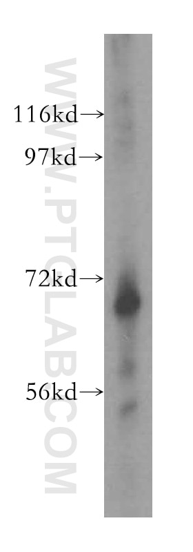 Western Blot (WB) analysis of human heart tissue using LRCH3 Polyclonal antibody (15800-1-AP)
