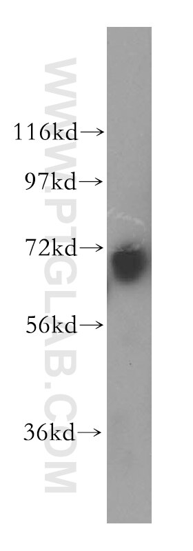 Western Blot (WB) analysis of human spleen tissue using LRCH3 Polyclonal antibody (15800-1-AP)