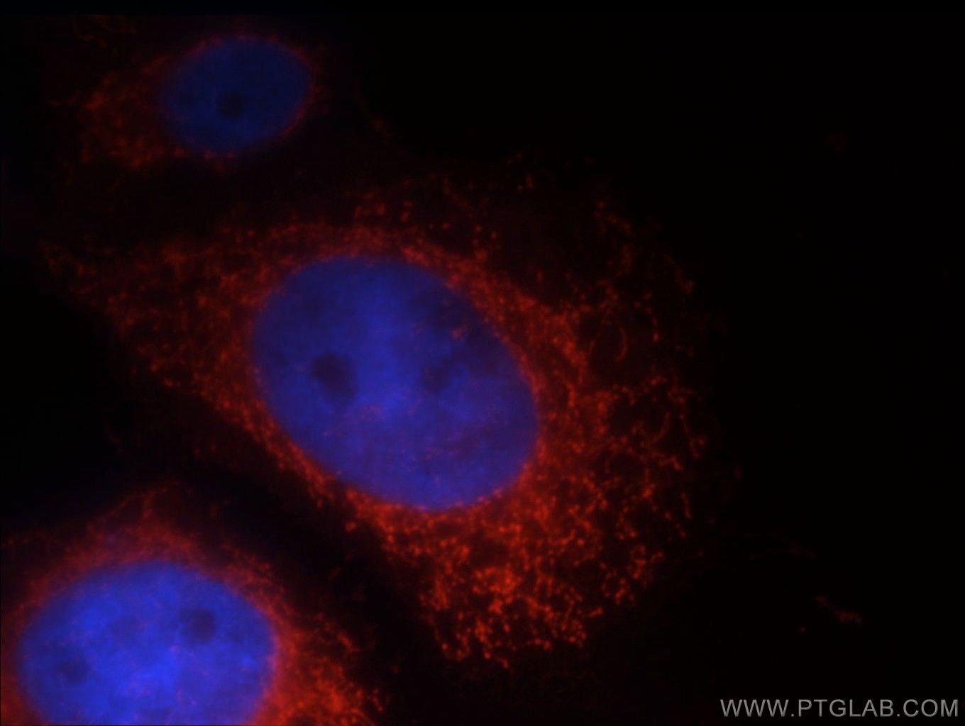 Immunofluorescence (IF) / fluorescent staining of HeLa cells using LRDD Polyclonal antibody (12119-1-AP)