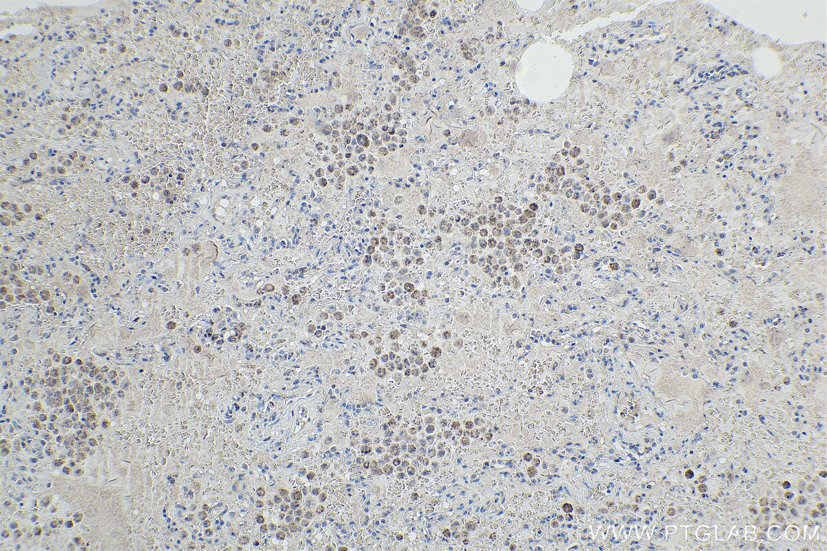 Immunohistochemistry (IHC) staining of human lung tissue using LRDD Polyclonal antibody (12119-1-AP)