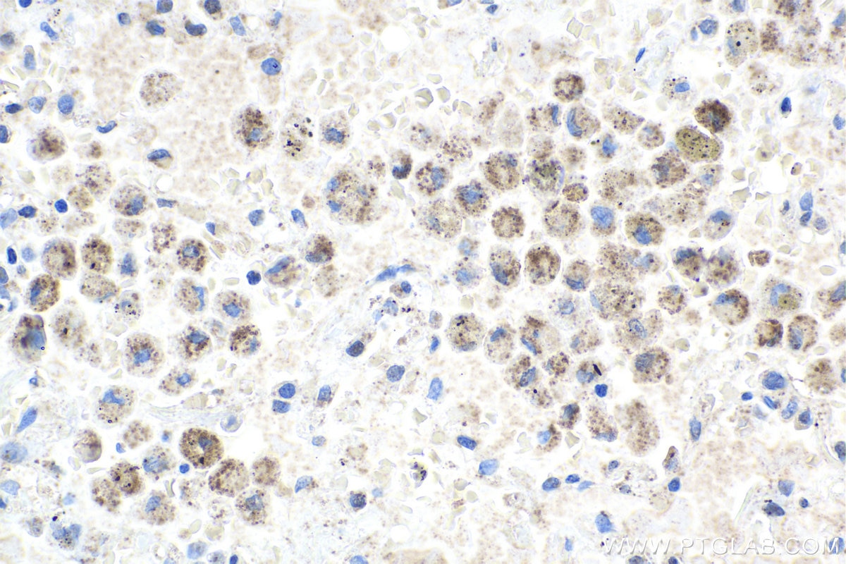 Immunohistochemistry (IHC) staining of human lung tissue using LRDD Polyclonal antibody (12119-1-AP)