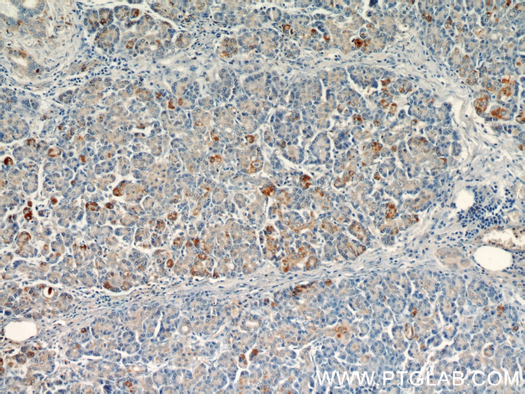 Immunohistochemistry (IHC) staining of human pancreas tissue using LRDD Polyclonal antibody (12119-1-AP)