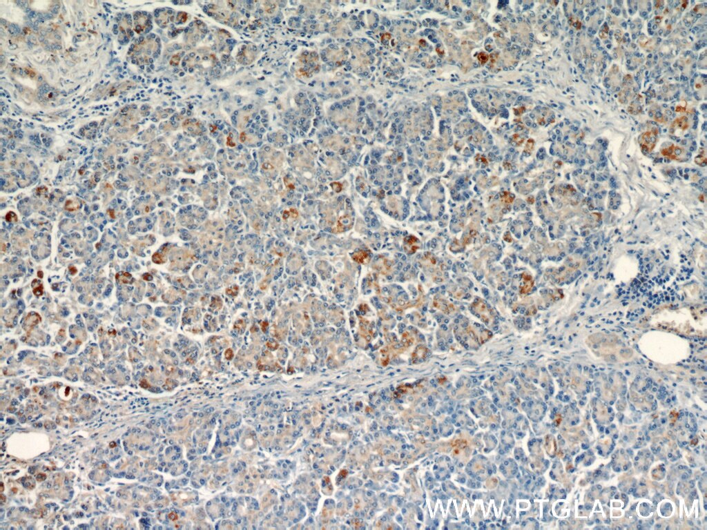 IHC staining of human pancreas using 12119-1-AP