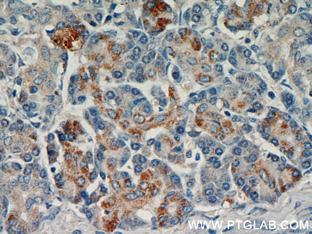 Immunohistochemistry (IHC) staining of human pancreas tissue using LRDD Polyclonal antibody (12119-1-AP)