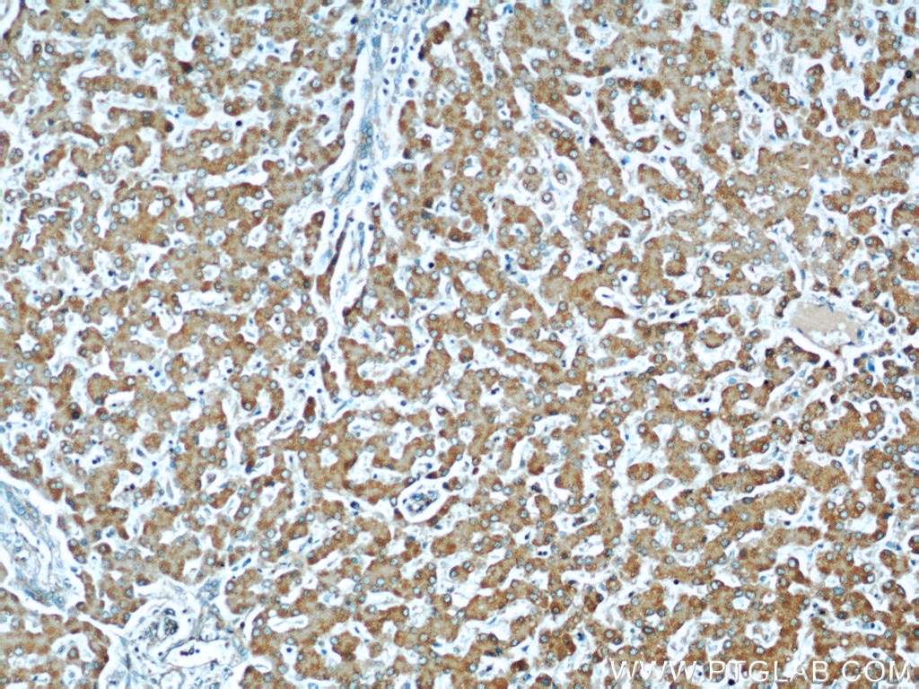 Immunohistochemistry (IHC) staining of human liver tissue using LRDD Polyclonal antibody (12119-1-AP)