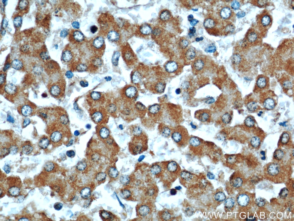 Immunohistochemistry (IHC) staining of human liver tissue using LRDD Polyclonal antibody (12119-1-AP)