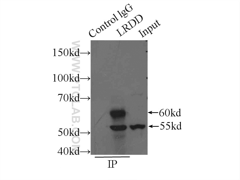 Immunoprecipitation (IP) experiment of L02 cells using LRDD Polyclonal antibody (12119-1-AP)