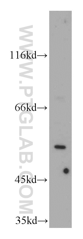 Western Blot (WB) analysis of HEK-293 cells using LRDD Polyclonal antibody (12119-1-AP)