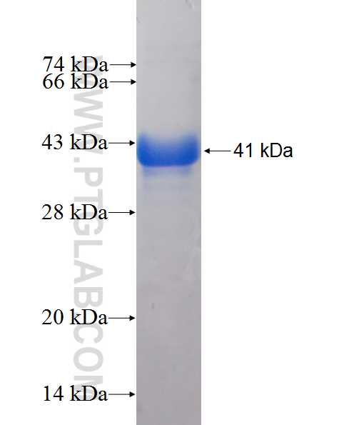 LRDD fusion protein Ag2761 SDS-PAGE