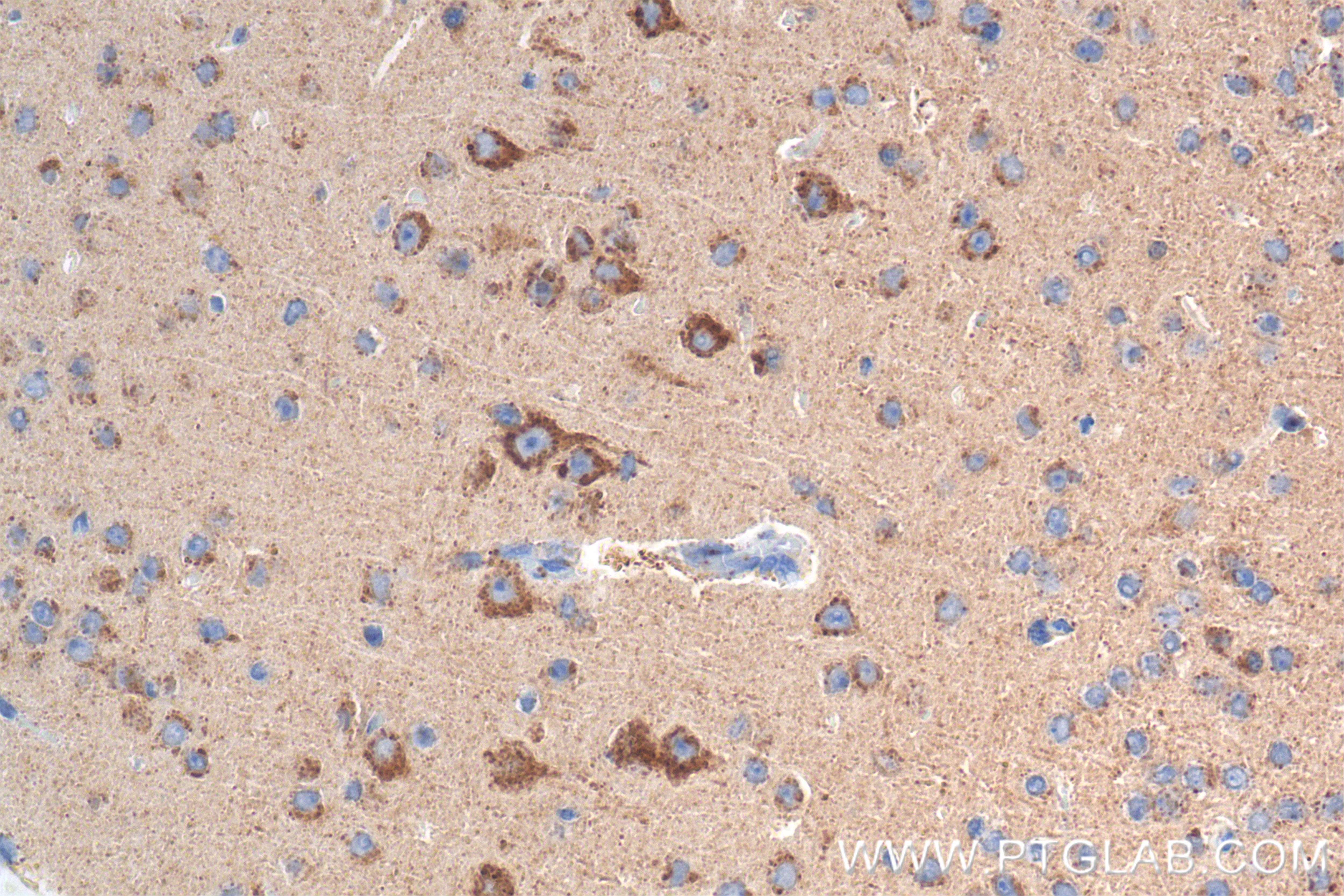 Immunohistochemistry (IHC) staining of mouse brain tissue using LRFN5 Recombinant antibody (83880-5-RR)