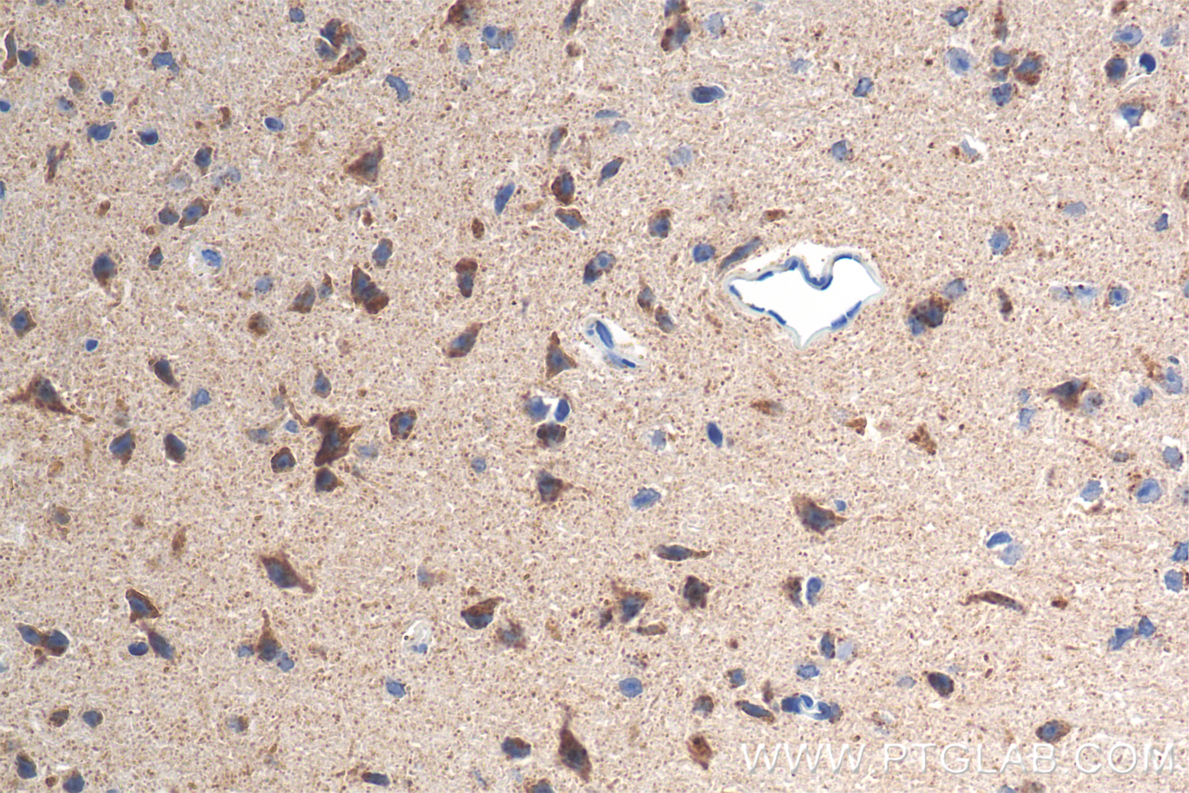 Immunohistochemistry (IHC) staining of mouse brain tissue using LRFN5 Recombinant antibody (83880-5-RR)
