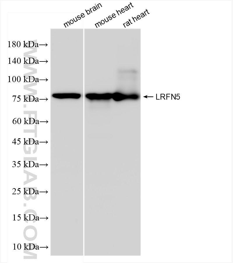 Western Blot (WB) analysis of various lysates using LRFN5 Recombinant antibody (83880-5-RR)