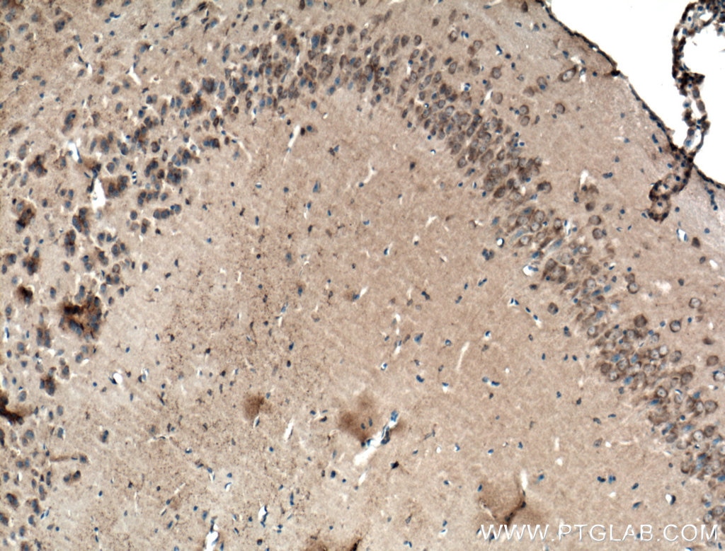 Immunohistochemistry (IHC) staining of mouse brain tissue using LRG1 Polyclonal antibody (13224-1-AP)