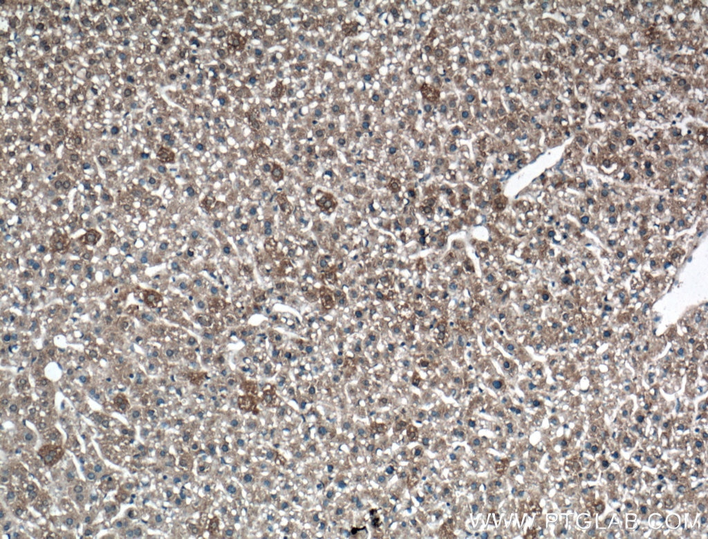 Immunohistochemistry (IHC) staining of mouse liver tissue using LRG1 Polyclonal antibody (13224-1-AP)