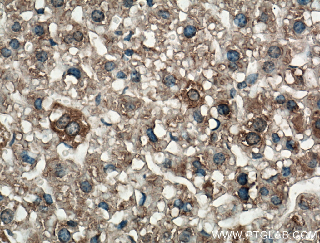 Immunohistochemistry (IHC) staining of mouse liver tissue using LRG1 Polyclonal antibody (13224-1-AP)