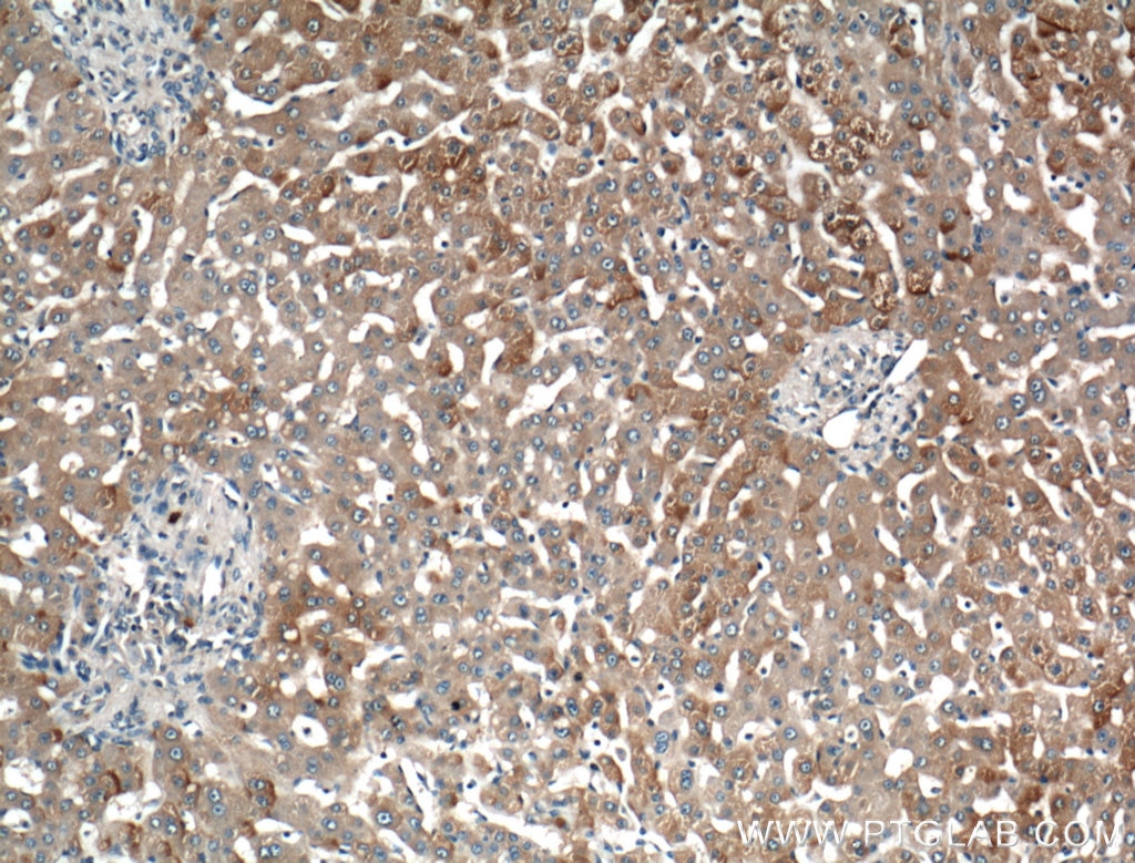 Immunohistochemistry (IHC) staining of human liver tissue using LRG1 Polyclonal antibody (13224-1-AP)