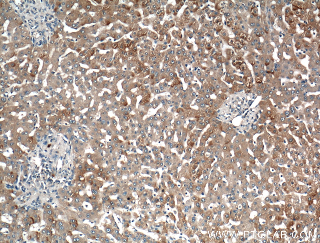 IHC staining of human liver using 13224-1-AP