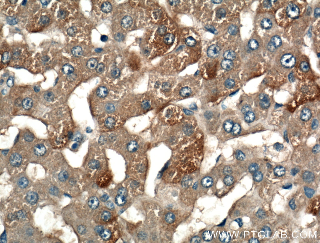 Immunohistochemistry (IHC) staining of human liver tissue using LRG1 Polyclonal antibody (13224-1-AP)