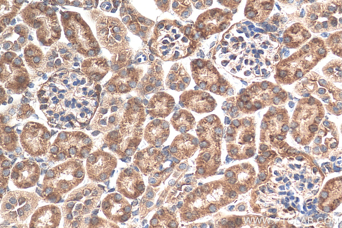 Immunohistochemistry (IHC) staining of mouse kidney tissue using LRIG1 Polyclonal antibody (22383-1-AP)