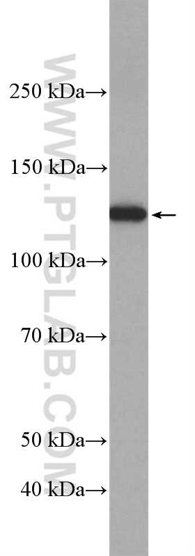 Western Blot (WB) analysis of mouse liver tissue using LRIG1 Polyclonal antibody (22383-1-AP)