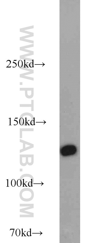 Western Blot (WB) analysis of mouse skin tissue using LRIG1 Polyclonal antibody (22383-1-AP)