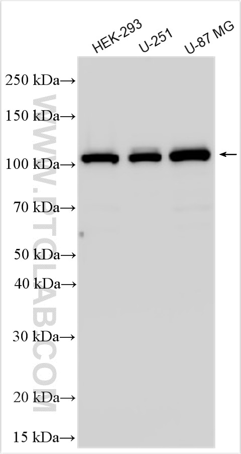 Western Blot (WB) analysis of various lysates using LRIG3 Polyclonal antibody (33107-1-AP)