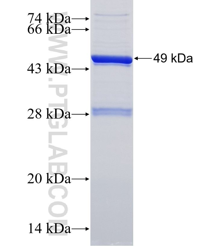 LRMDA fusion protein Ag33898 SDS-PAGE