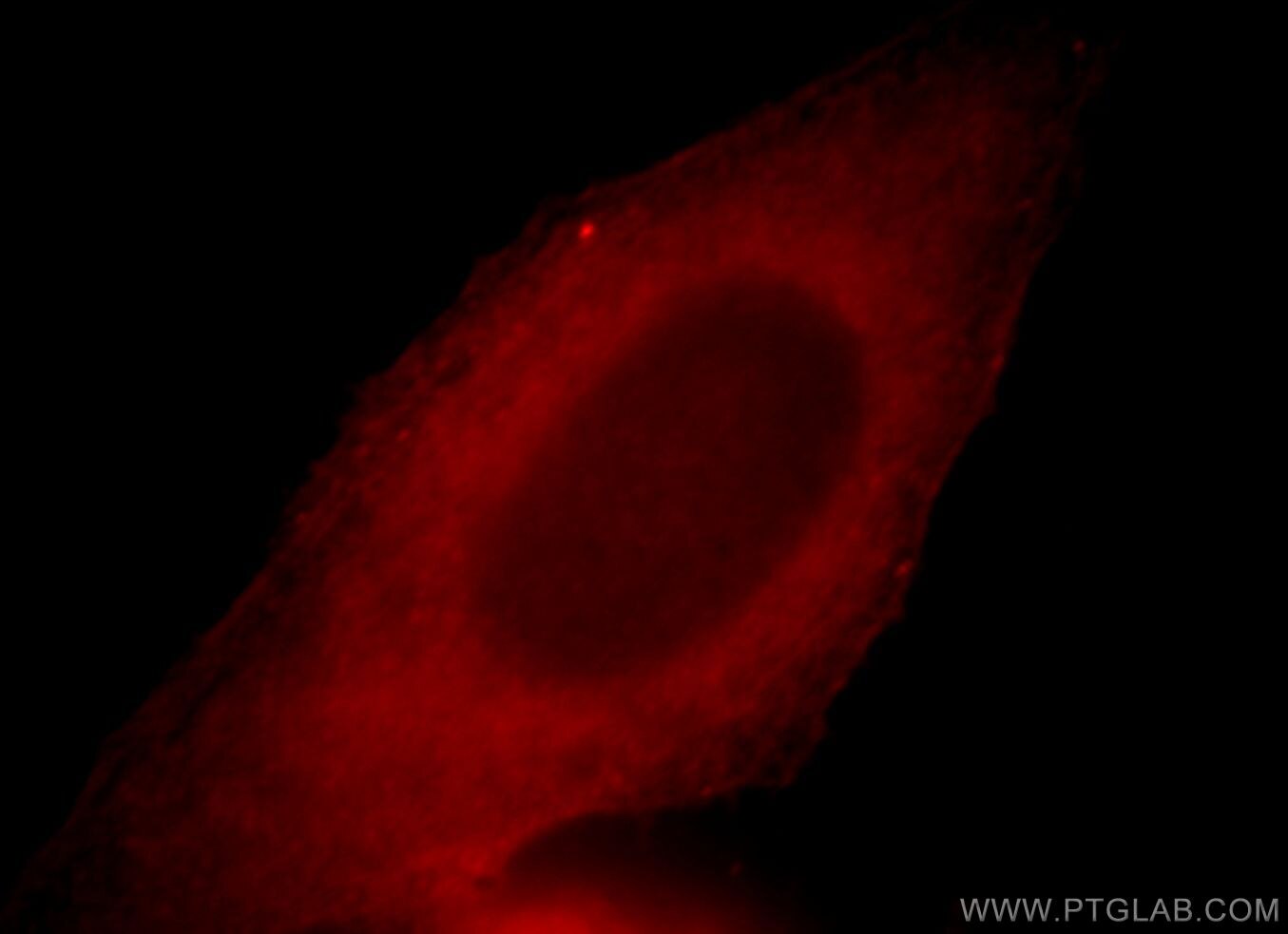 Immunofluorescence (IF) / fluorescent staining of HepG2 cells using LRMP Polyclonal antibody (19498-1-AP)