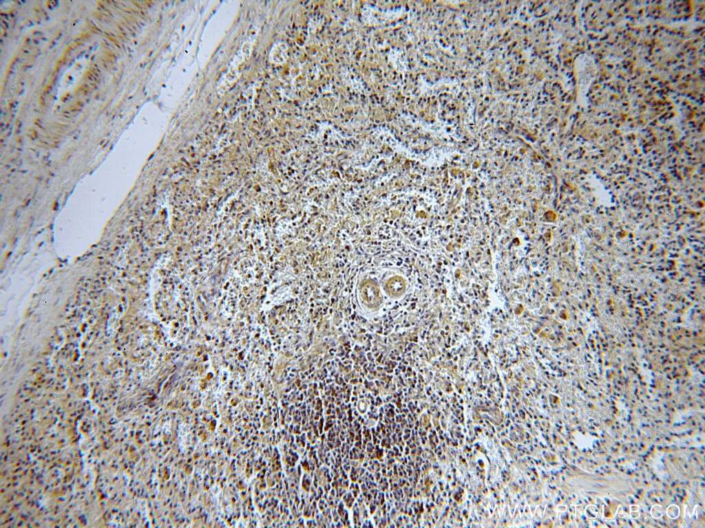 Immunohistochemistry (IHC) staining of human spleen tissue using LRMP Polyclonal antibody (19498-1-AP)