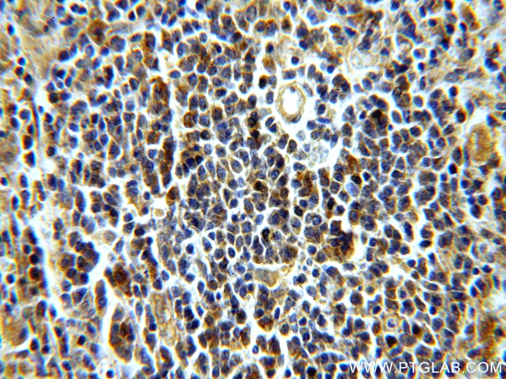 Immunohistochemistry (IHC) staining of human spleen tissue using LRMP Polyclonal antibody (19498-1-AP)