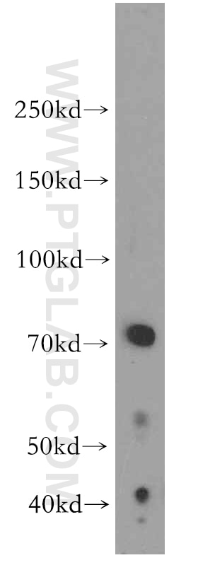 Western Blot (WB) analysis of Raji cells using LRMP Polyclonal antibody (19498-1-AP)